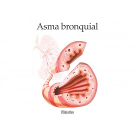 Asma Bronquial-ComercializadoraZeus- 1038051136